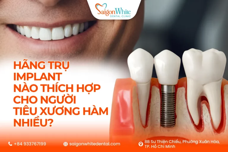 Hãng trụ implant nào cho người tiêu xương hàm nhiều