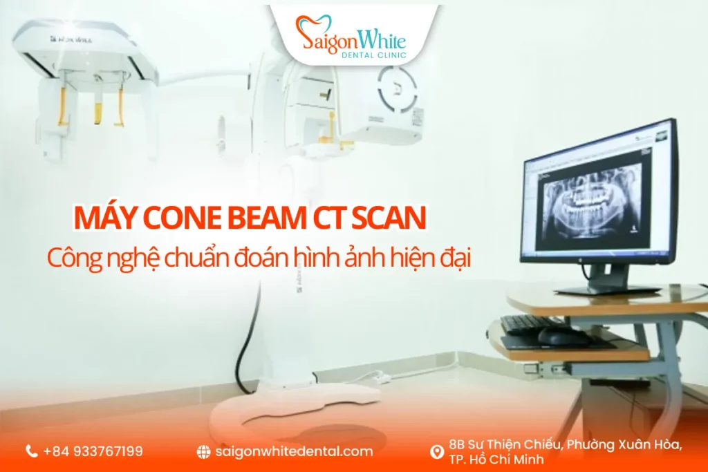 Máy Cone Beam CT scan - Công nghệ chuẩn đoán hình ảnh hiện đại