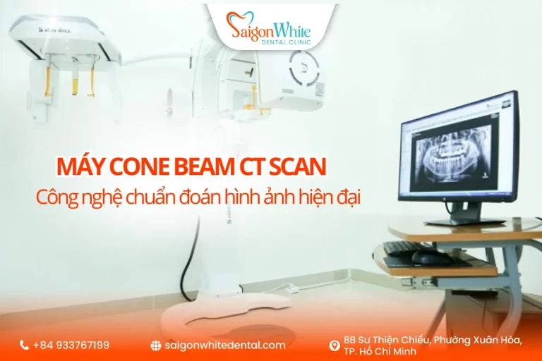 Máy Cone Beam CT scan - Công nghệ chuẩn đoán hình ảnh hiện đại