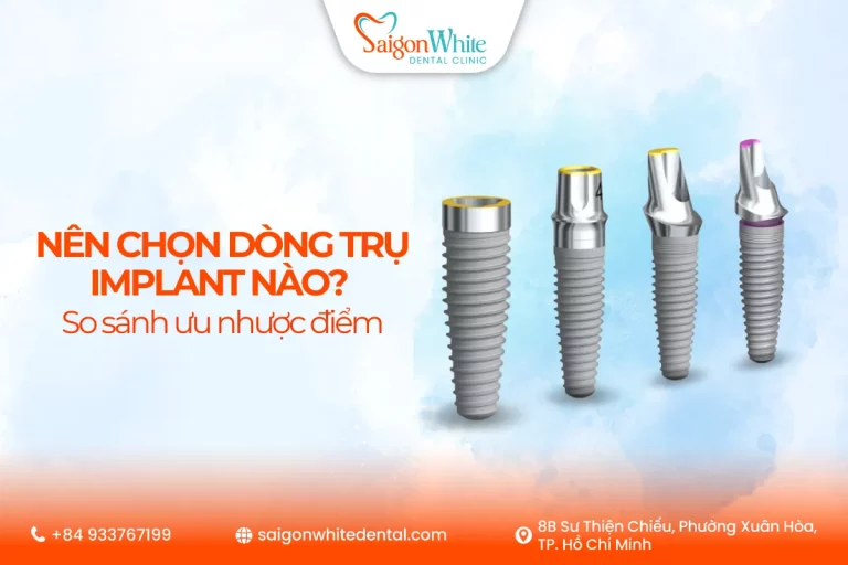Nên chọn dòng trụ implant nào? So sánh ưu nhược điểm