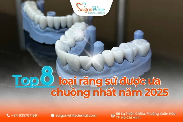 Top 8 loại răng sứ được ưa chuộng nhất năm 2025