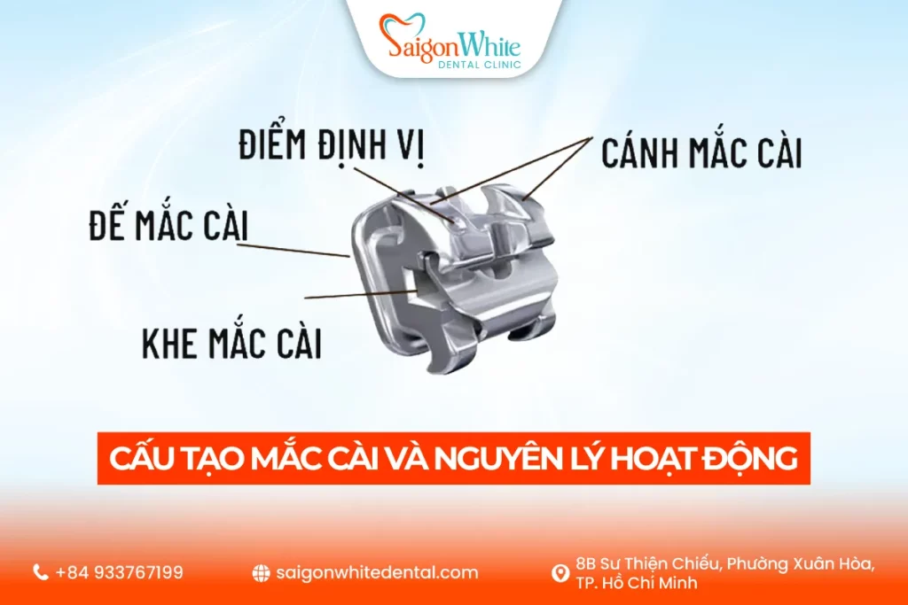 Tổng quan cấu tạo của mắc cài