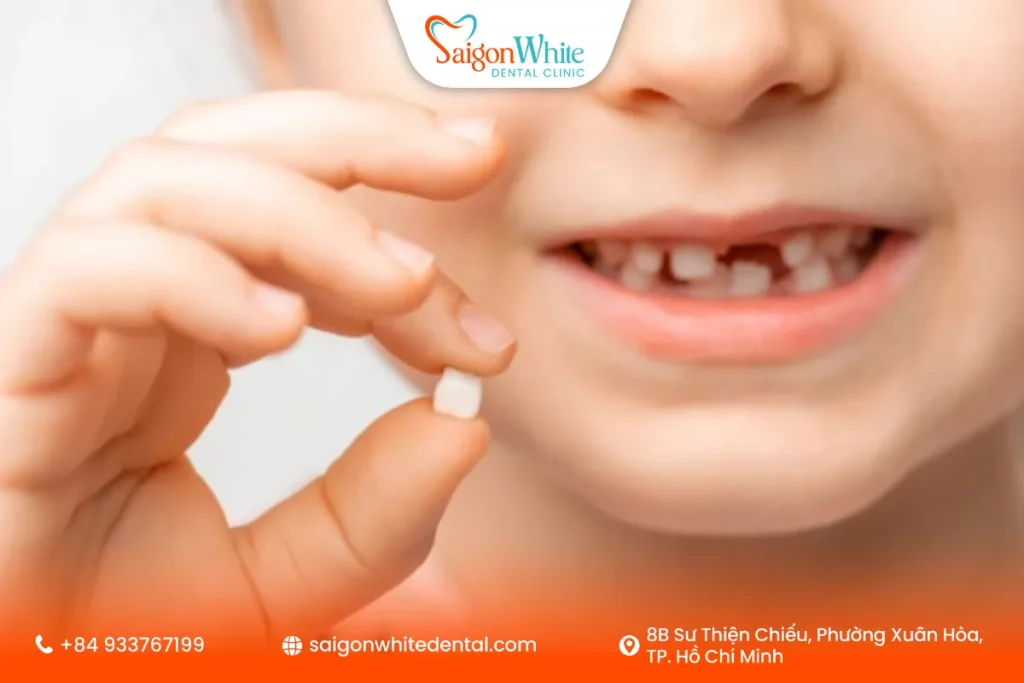 Dấu hiệu răng sữa của bé tới thời kì thay răng