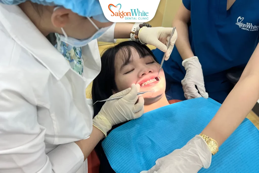 Dịch vụ niềng răng tại Nha khoa Sài Gòn White
