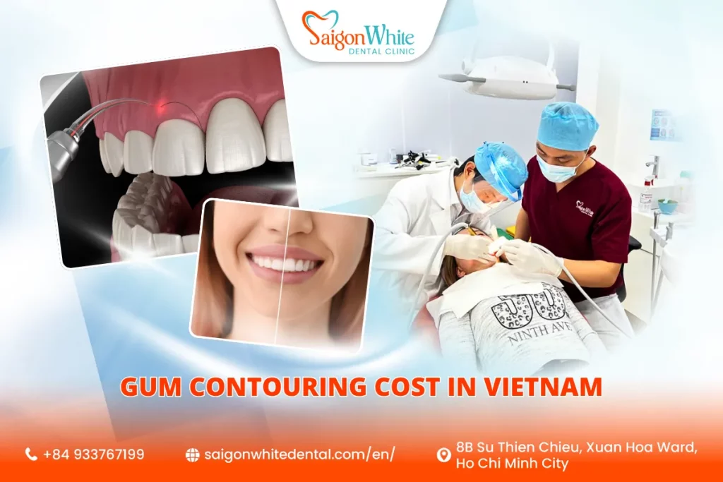 How Much Does Gum Contouring Cost in Vietnam?