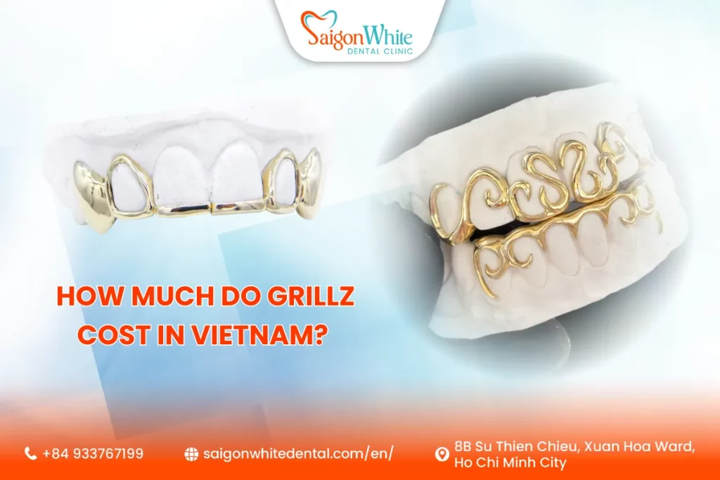 How Much Do Grillz Cost in Vietnam? (Full Price Breakdown)
