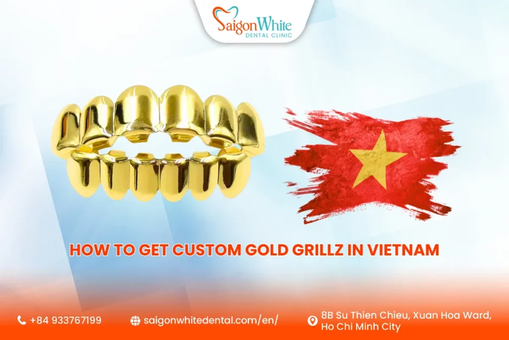 How to Get Custom Gold Grillz in Vietnam
