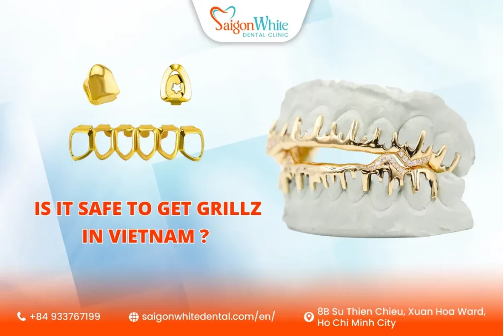 Is It Safe to Get Grillz in Vietnam? 