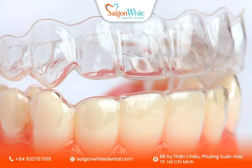 Khay niềng trong suốt là gì?