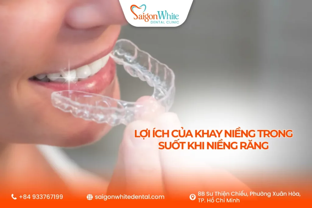Lợi ích của khay niềng trong suốt khi nieng rang