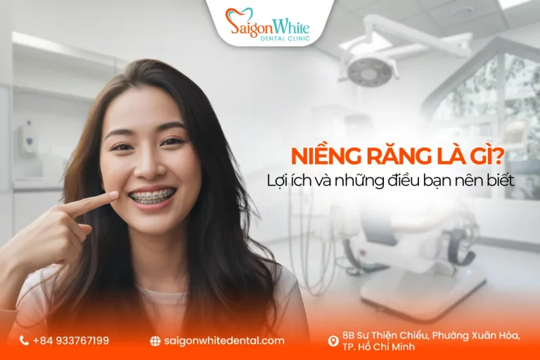Niềng răng là gì?
