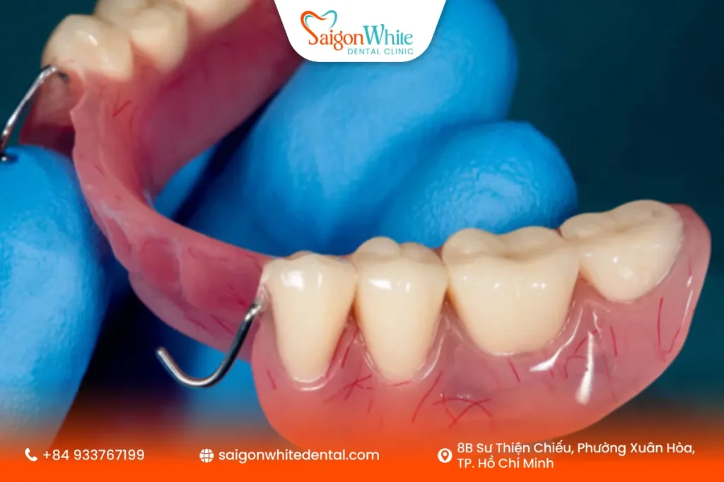 Răng giả tháo lắp bán phần