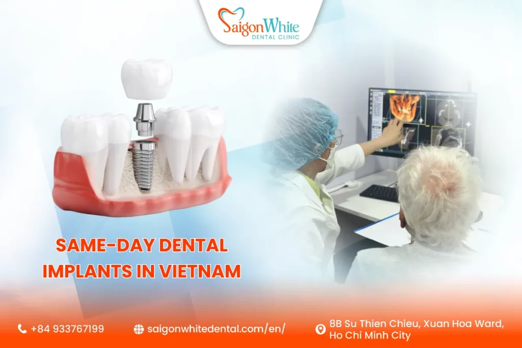 Same-day dental implants in Vietnam