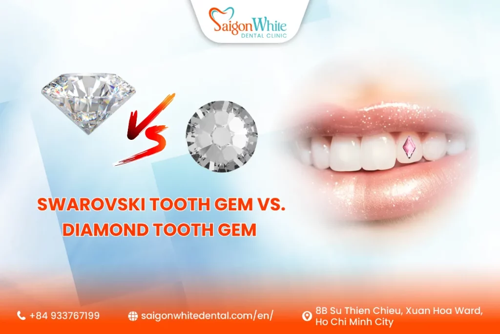 Swarovski Tooth Gem vs. Diamond Tooth Gem