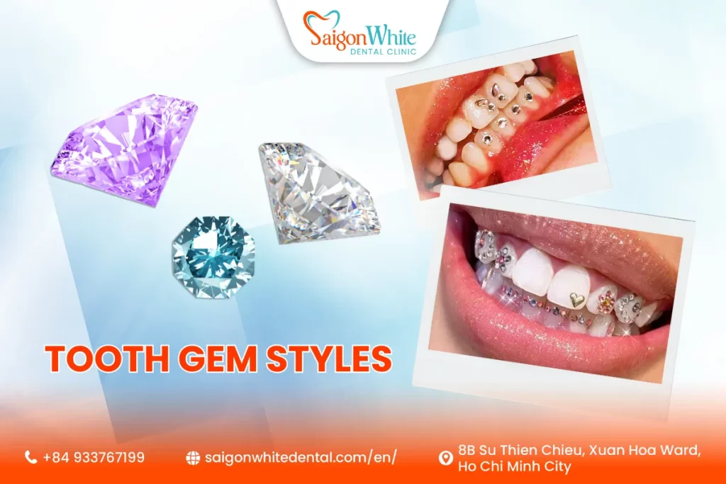 Tooth Gem Styles