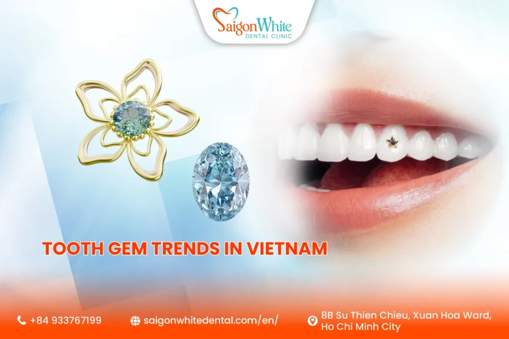 Tooth Gem Trends in Vietnam