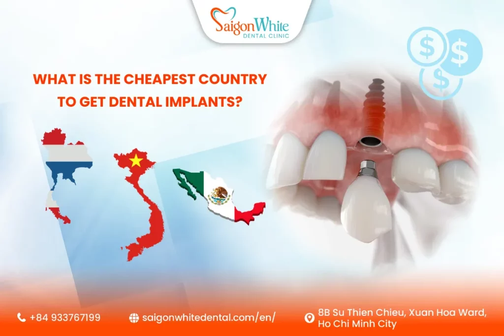 What is the cheapest country to get dental implants?