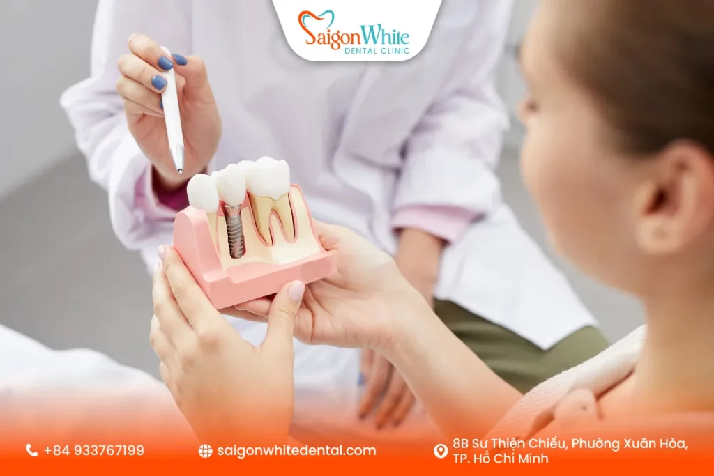 Cách chăm sóc răng implant sau khi cấy ghép