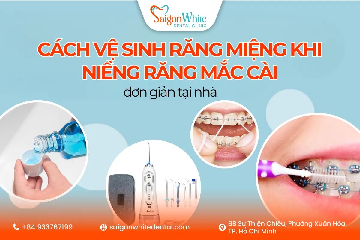 Ve Rang Cách vệ sinh răng miệng khi niềng răng mắc cài đơn giản tại nhà