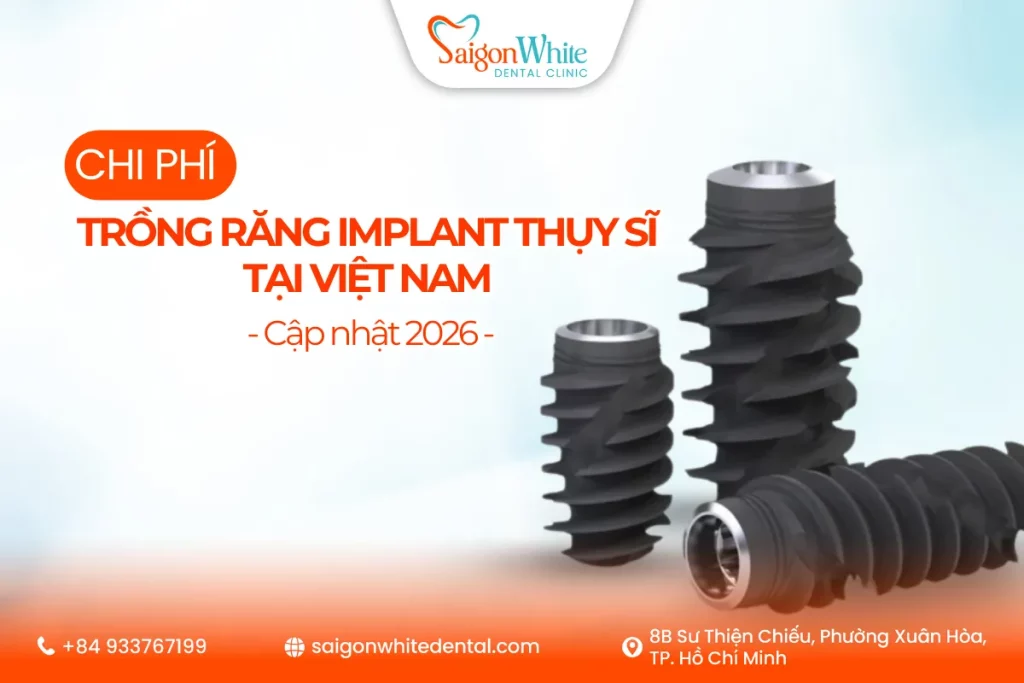 Chi phí trồng răng implant Thụy Sĩ tại Việt Nam - Cập nhật 2026