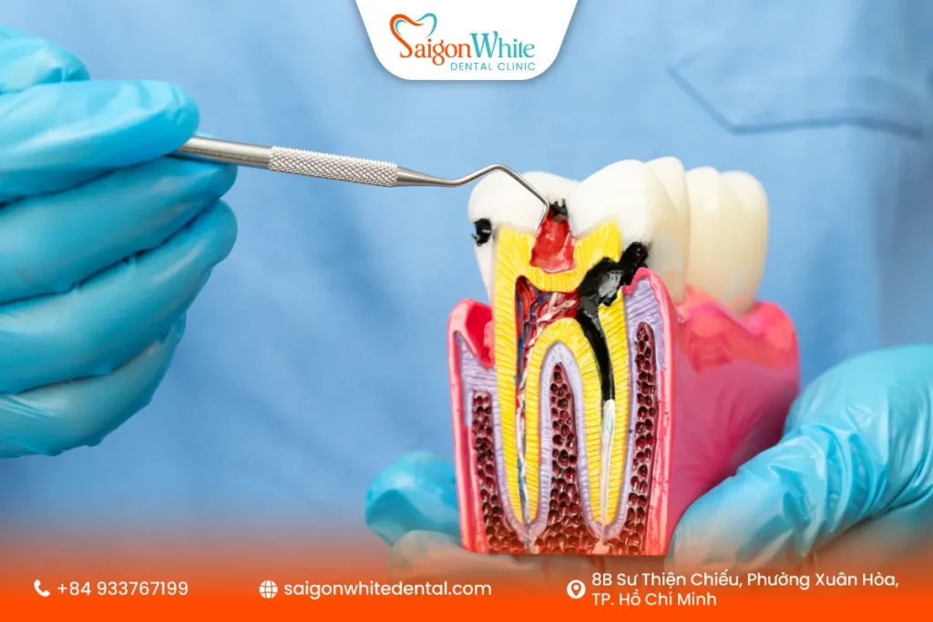 Điều trị tủy có đau không?