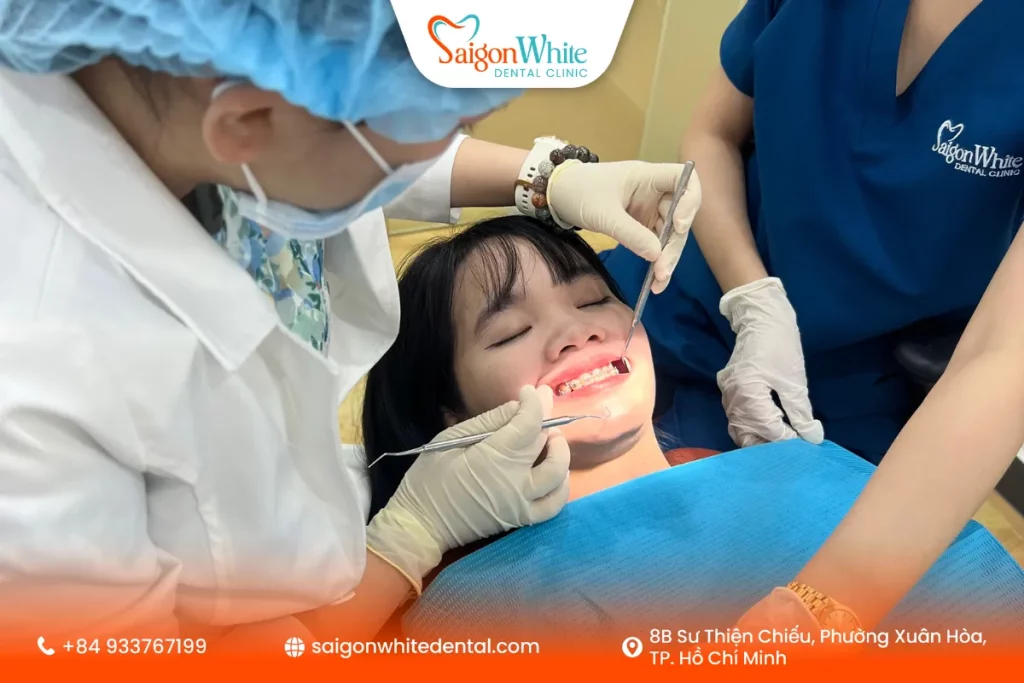 Tái khám niềng định kì theo nha khoa