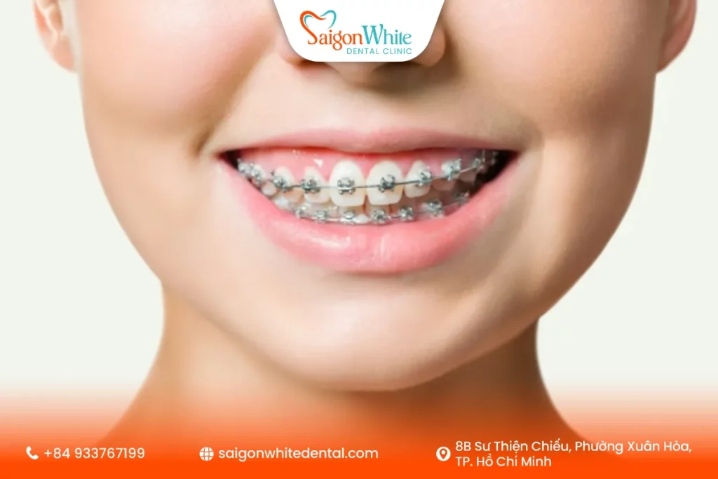 Khí cụ cố định