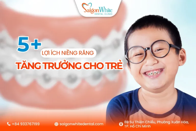Lợi ích niềng răng tăng trưởng cho trẻ