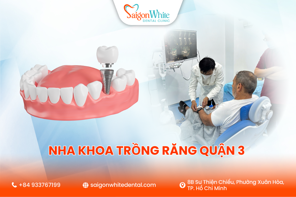 Nha Khoa Trồng Răng Giá Rẻ