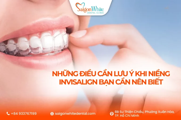 Những điều cần lưu ý khi niềng invisalign cần nên biết