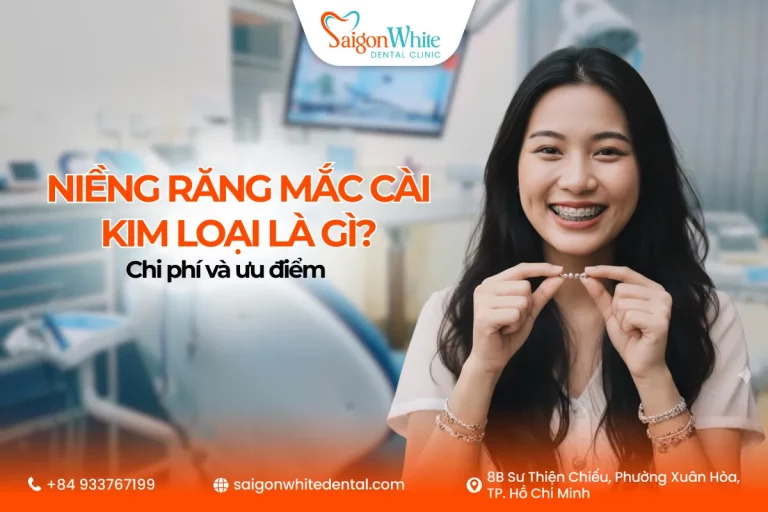 Niềng răng mắc cài kim loại