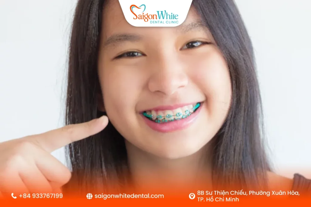 Niềng răng tăng trưởng là gì?