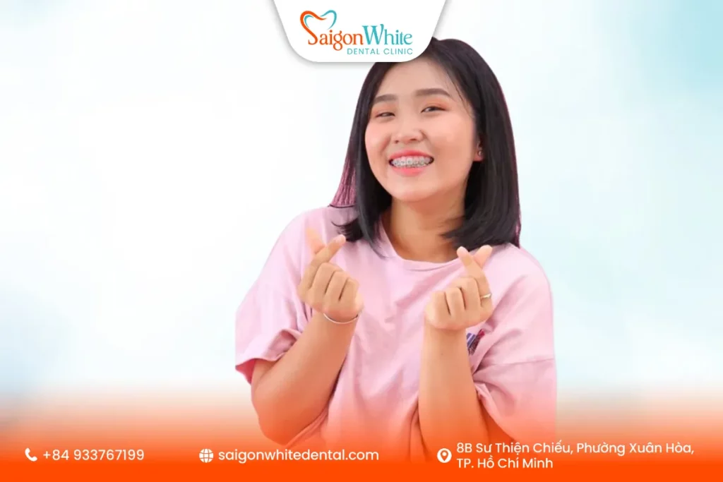 Niềng răng thông thường