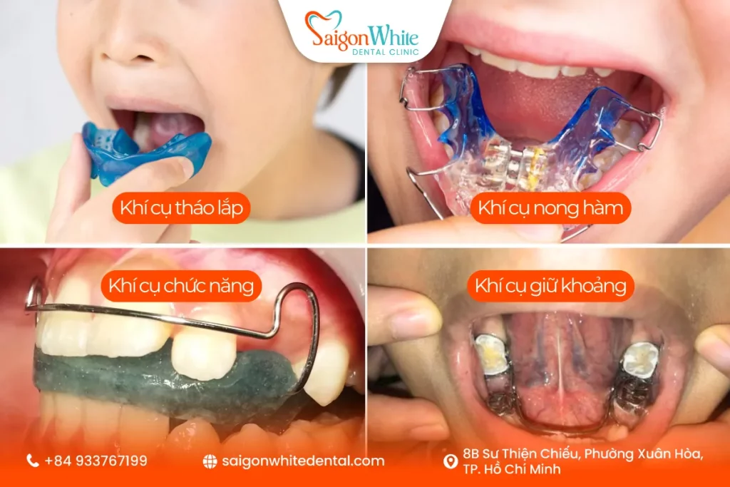 Các phương pháp chỉnh nha tăng trưởng và khí cụ thường sử dụng