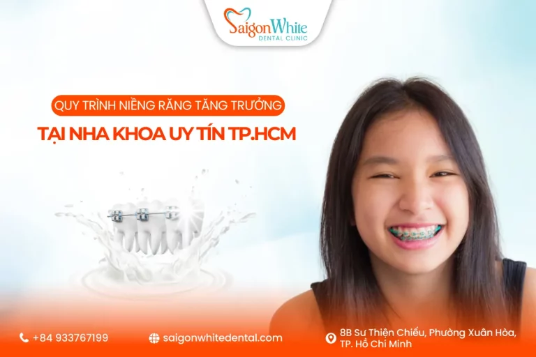 Quy trình niềng răng tăng trưởng tại nha khoa uy tín Tp.HCM