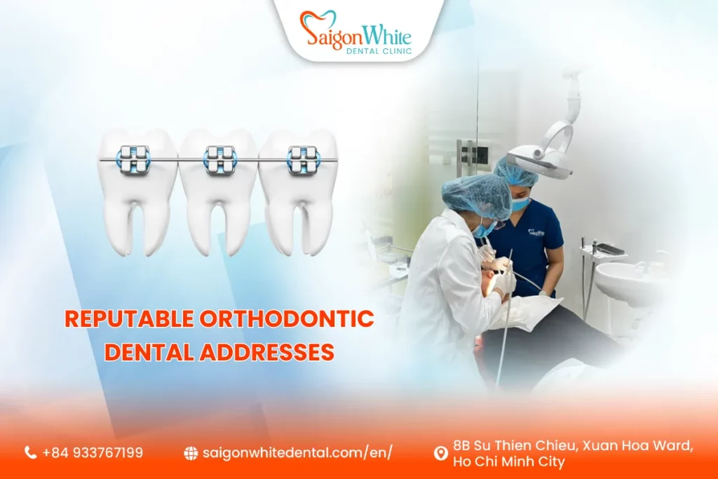 Reputable orthodontic dental addresses in Ho Chi Minh City
