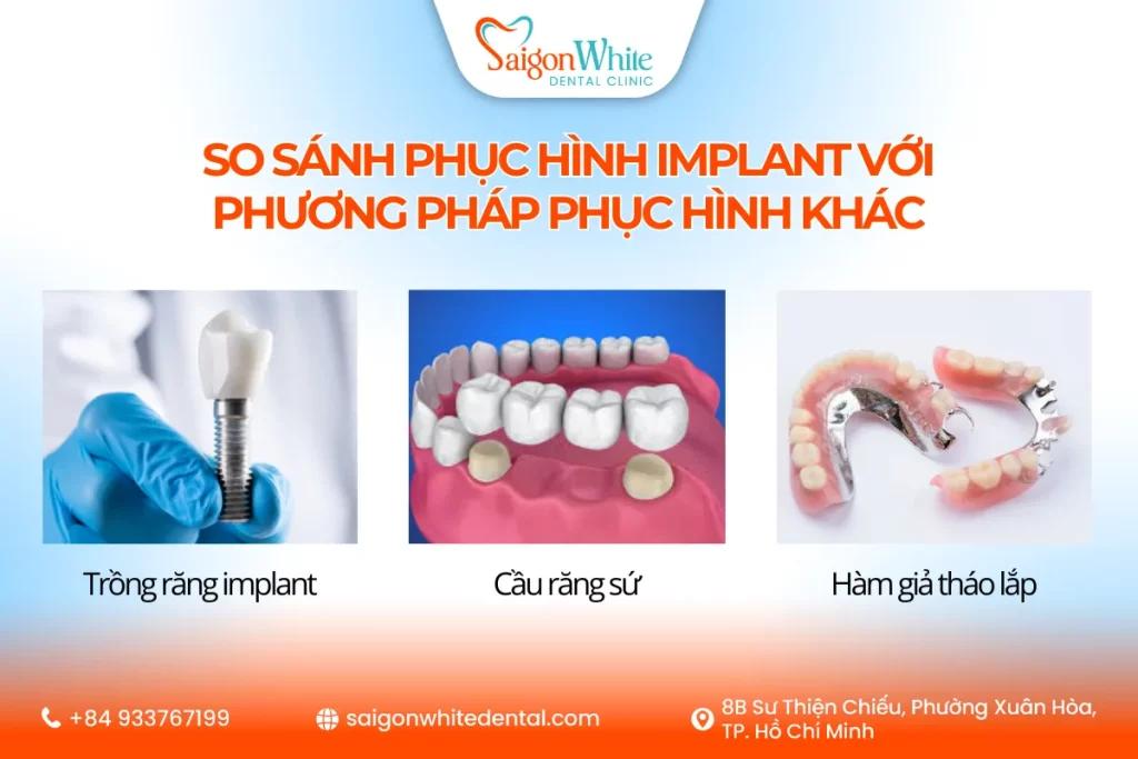 So sánh phục hình implant với phương pháp phục hình khác