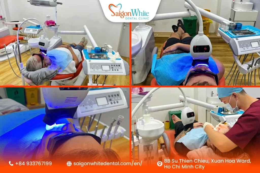 International patients get teeth whitening at Saigon White Dental Clinic.