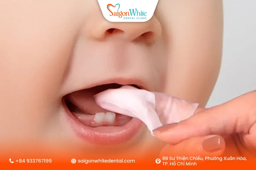 vệ sinh răng sữa của bé