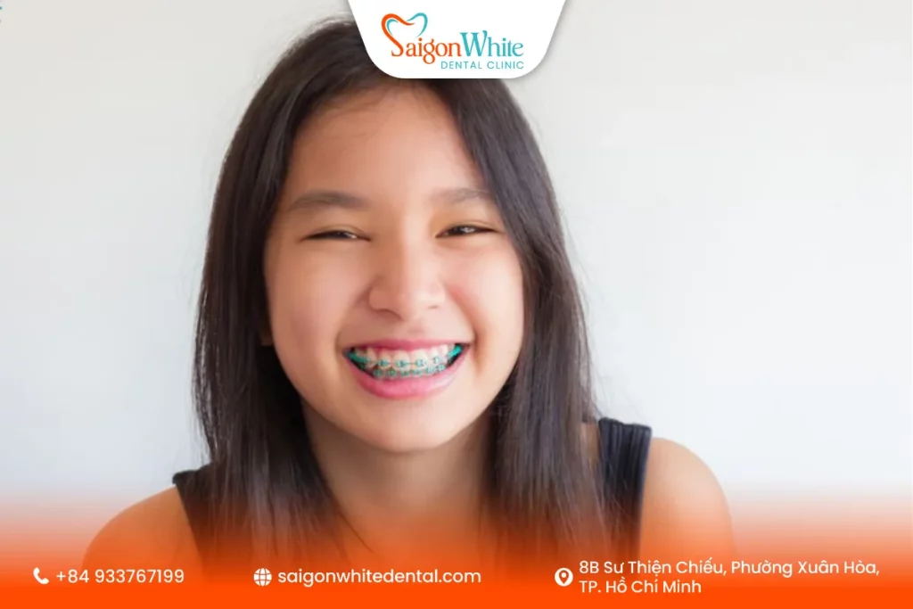Niềng răng tăng trưởng giúp can thiệp nhẹ nhàng, hiệu quả cao và tiết kiệm thời gian điều trị sau này