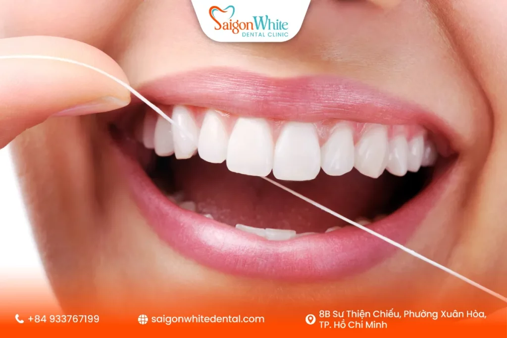 Chăm sóc răng miệng sau khi dán sứ Veneer siêu mỏng bằng chỉ khoa 