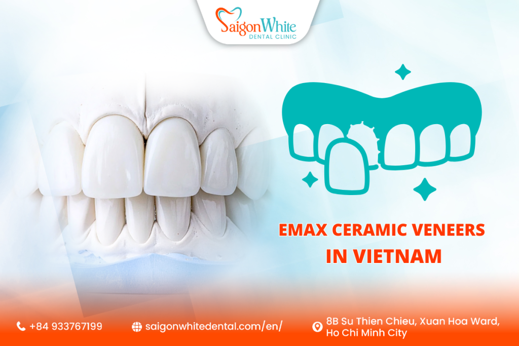 Emax Ceramic Veneers in Vietnam