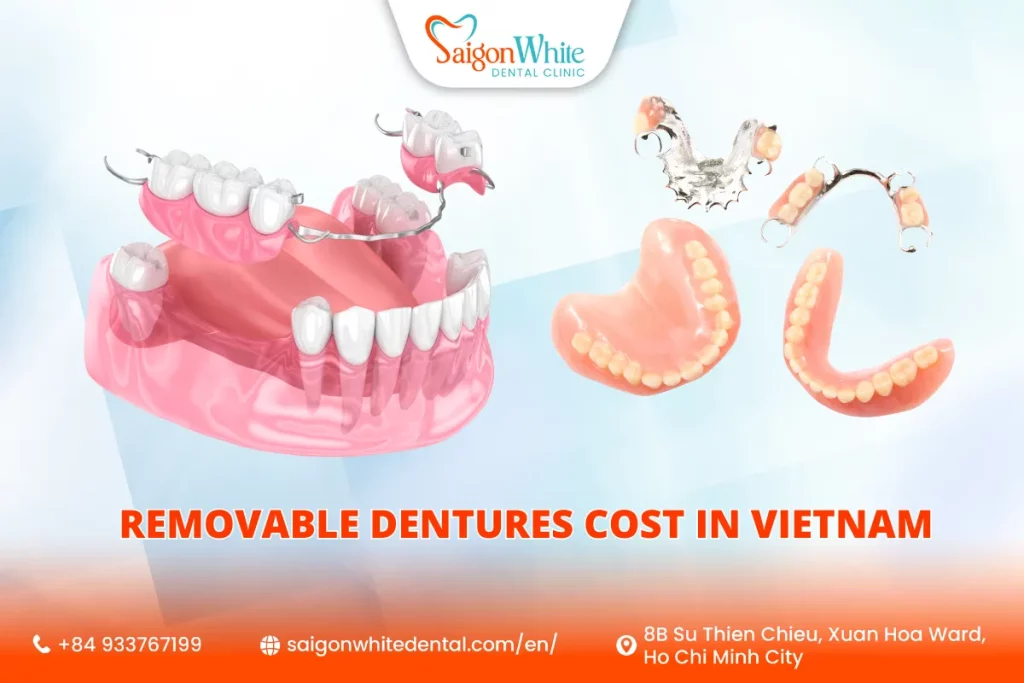 How Much Do Removable Dentures Cost in Vietnam?