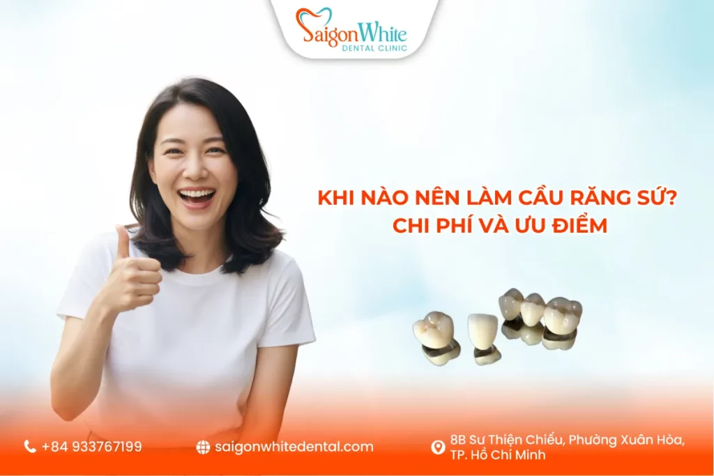 Khi nào nên làm cầu răng sứ? Chi phí và ưu điểm