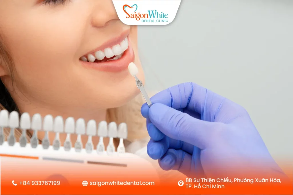 Lợi ích thẩm mỹ của dán skin veneer