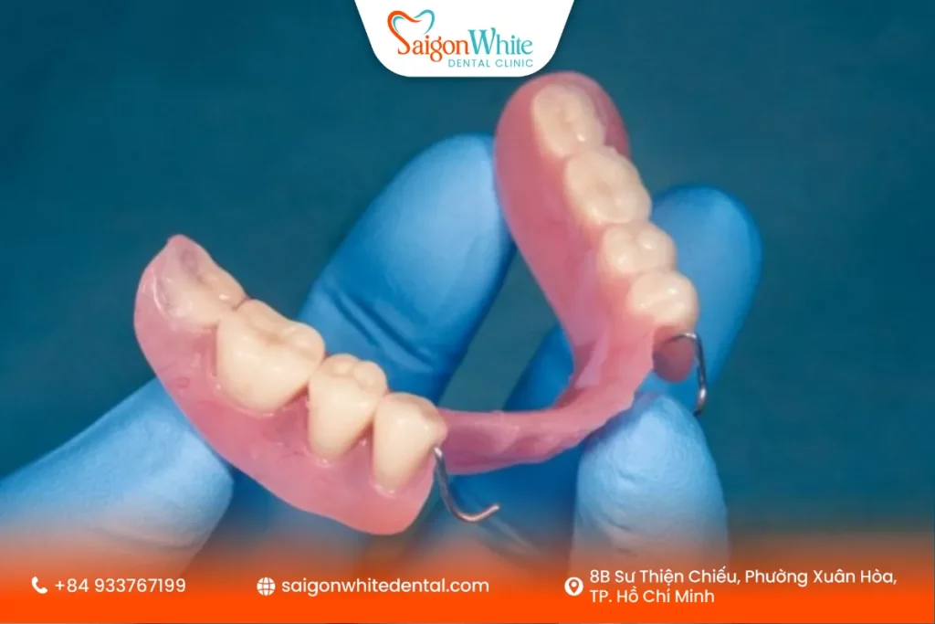 Răng giả tháo lắp là gì? Có phù hợp cho mọi đối tượng không?