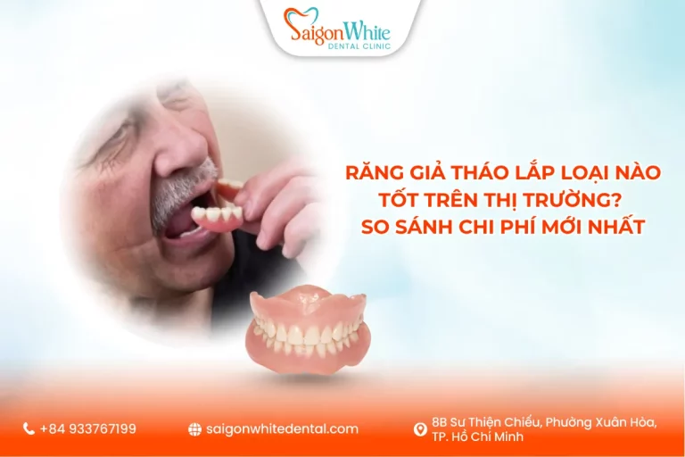 Răng giả tháo lắp loại nào tốt trên thị trường? So sánh chi phí mới nhất