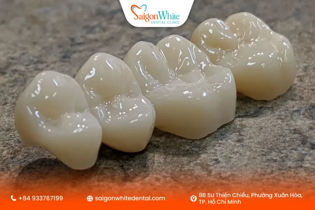 Vì sao nên làm cầu răng sứ tại nha khoa uy tín tại TP.HCM?