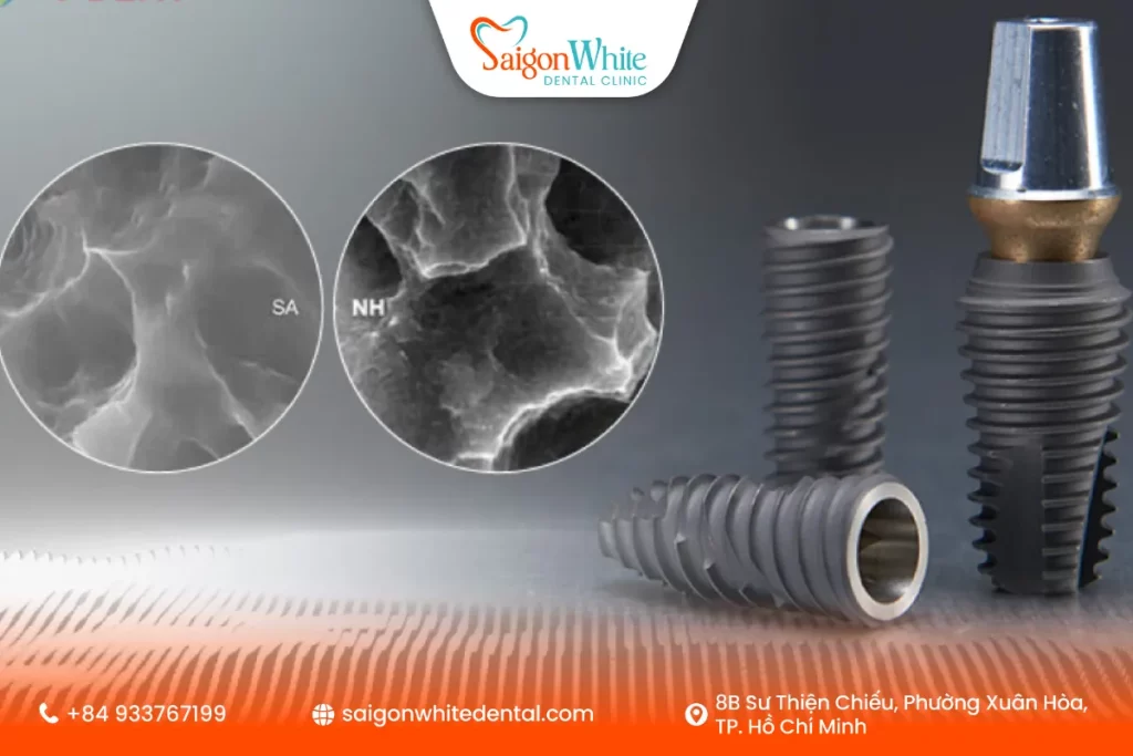What Are Hiossen Implants?