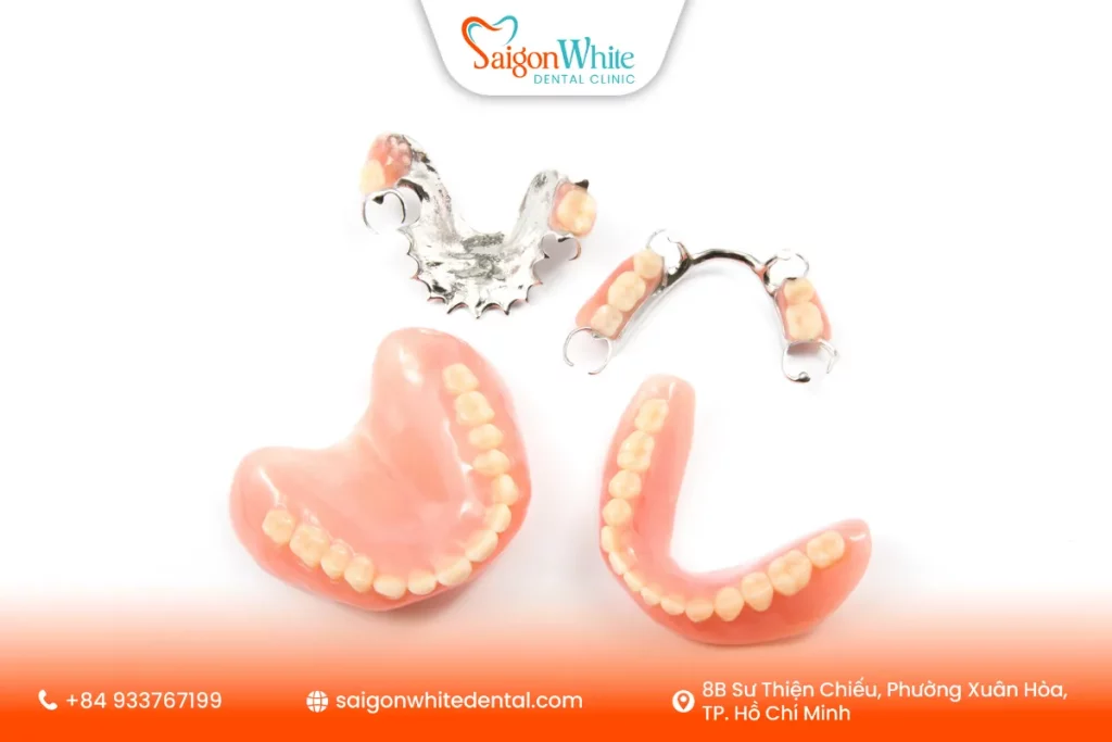 Các loại hàm răng giả tháo lắp phổ biến tại TP.HCM